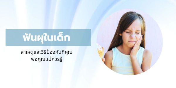 ฟันผุในเด็ก สาเหตุและวิธีป้องกันที่คุณพ่อคุณแม่ควรรู้